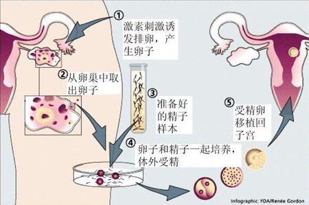 私人同性代怀助孕怎么收费